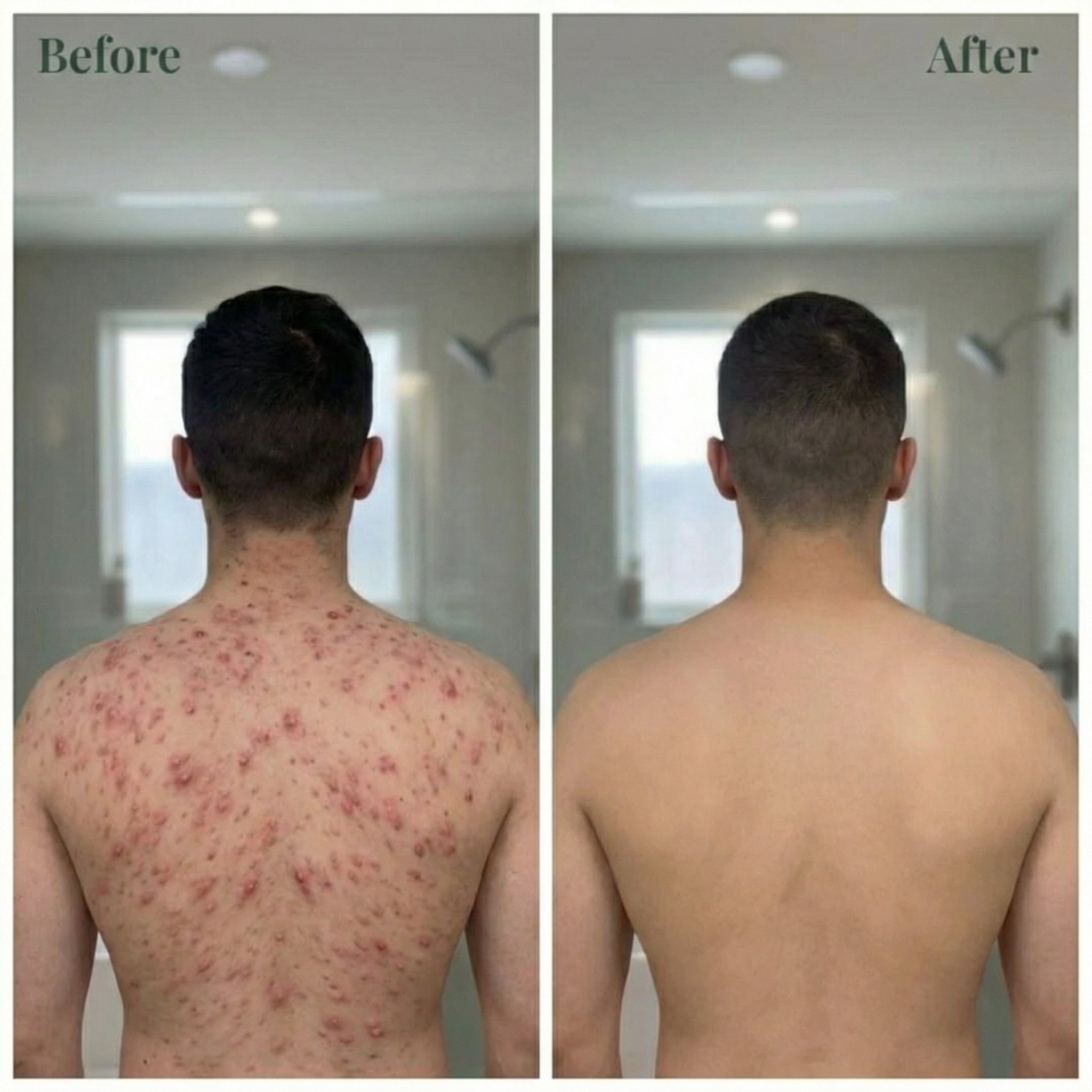 OREYA™ ANCE CLEAR BODY CLEANSER