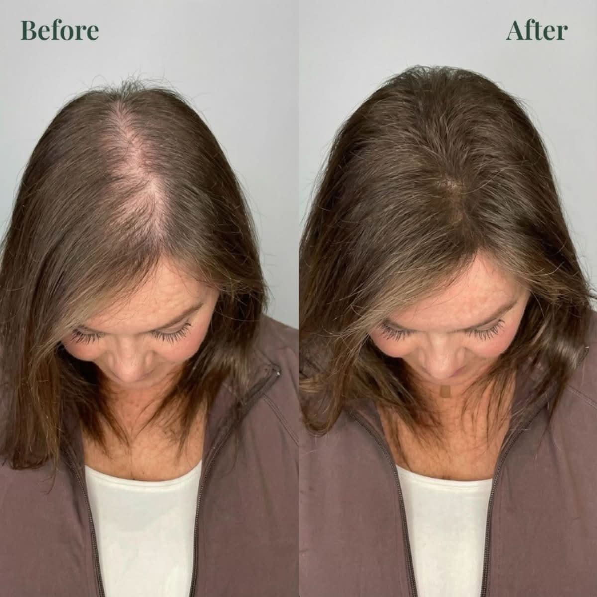 Oreya™ Growth Support Shampoo